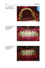 Functional Aesthetic Dentistry: How to Achieve Predictable Aesthetic Results Using Principles of a Stable Occlusion 2020 - Image 3