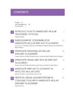 Immediate Molar Implants 2023 - Image 9