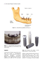 Peri-Implant Therapy for the Dental Hygienist 2022 - Image 3