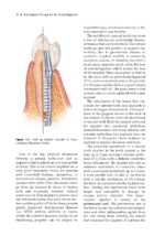 Peri-Implant Therapy for the Dental Hygienist 2022 - Image 5