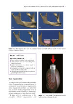 Peri-Implant Therapy for the Dental Hygienist 2022 - Image 7