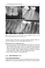 Common Complications in Endodontics 2025 - Image 10