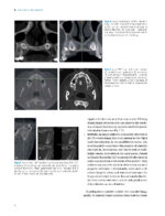 DIY Orthodontics: Design It Yourself 2021 - Image 8