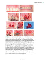 Best Practices in Implant Dentistry 2025 - Image 4