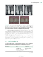 Best Practices in Implant Dentistry 2025 - Image 10