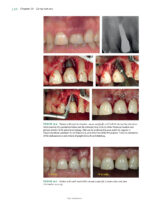 Best Practices in Implant Dentistry 2025 - Image 13