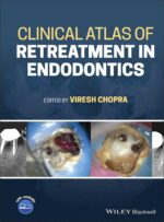 Clinical Atlas of Retreatment in Endodontics 2021