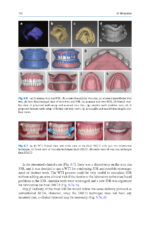 Digital Restorative Dentistry: A Guide to Materials, Equipment, and Clinical Procedures - Image 2