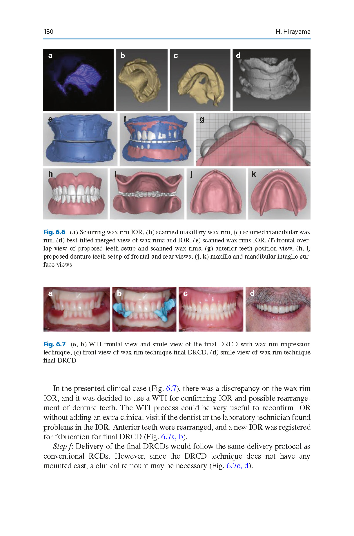 Digital_Restorative_Dentistry_A_Guide_to_Materials,_Equipment_2019_Page_01 Digital Restorative Dentistry: A Guide to Materials, Equipment, and Clinical Procedures - Image 2