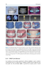 Digital Restorative Dentistry: A Guide to Materials, Equipment, and Clinical Procedures - Image 3