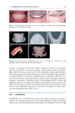 Digital Restorative Dentistry: A Guide to Materials, Equipment, and Clinical Procedures - Image 4