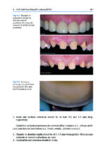 Digital Restorative Dentistry: A Guide to Materials, Equipment, and Clinical Procedures - Image 6