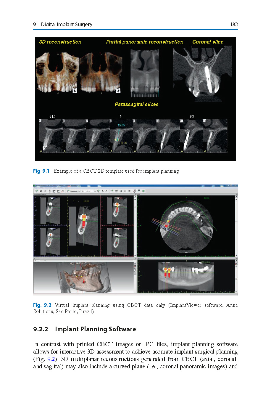 Digital_Restorative_Dentistry_A_Guide_to_Materials,_Equipment_2019_Page_06 Digital Restorative Dentistry: A Guide to Materials, Equipment, and Clinical Procedures - Image 7