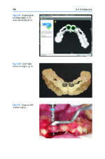 Digital Restorative Dentistry: A Guide to Materials, Equipment, and Clinical Procedures - Image 9