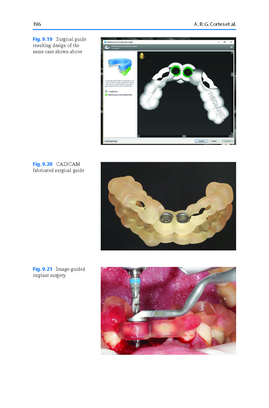 Digital_Restorative_Dentistry_A_Guide_to_Materials,_Equipment_2019_Page_08 Digital Restorative Dentistry: A Guide to Materials, Equipment, and Clinical Procedures - Image 9