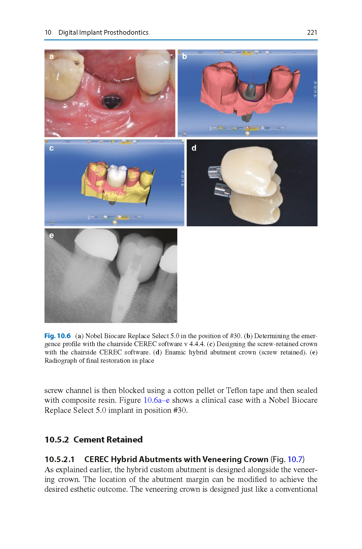 Digital_Restorative_Dentistry_A_Guide_to_Materials,_Equipment_2019_Page_09 Digital Restorative Dentistry: A Guide to Materials, Equipment, and Clinical Procedures - Image 10