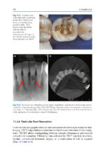 Digital Restorative Dentistry: A Guide to Materials, Equipment, and Clinical Procedures - Image 11