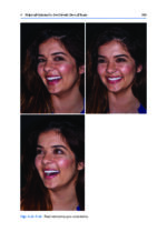 Esthetic Oral Rehabilitation with Veneers: A Guide to Treatment Preparation and Clinical Concepts 2020 - Image 12