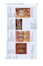 Esthetic Oral Rehabilitation with Veneers: A Guide to Treatment Preparation and Clinical Concepts 2020 - Image 9