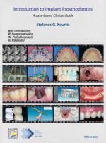 Introduction to Implant Prosthodontics: A case-based Clinical Guide 2022
