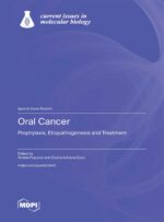 Oral Cancer Prophylaxis, Etiopathogenesis and Treatment 2025