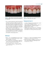 Oral and Maxillofacial Surgery, Medicine, and Pathology for the Clinician 2023 - Image 3