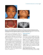 Oral and Maxillofacial Surgery, Medicine, and Pathology for the Clinician 2023 - Image 6