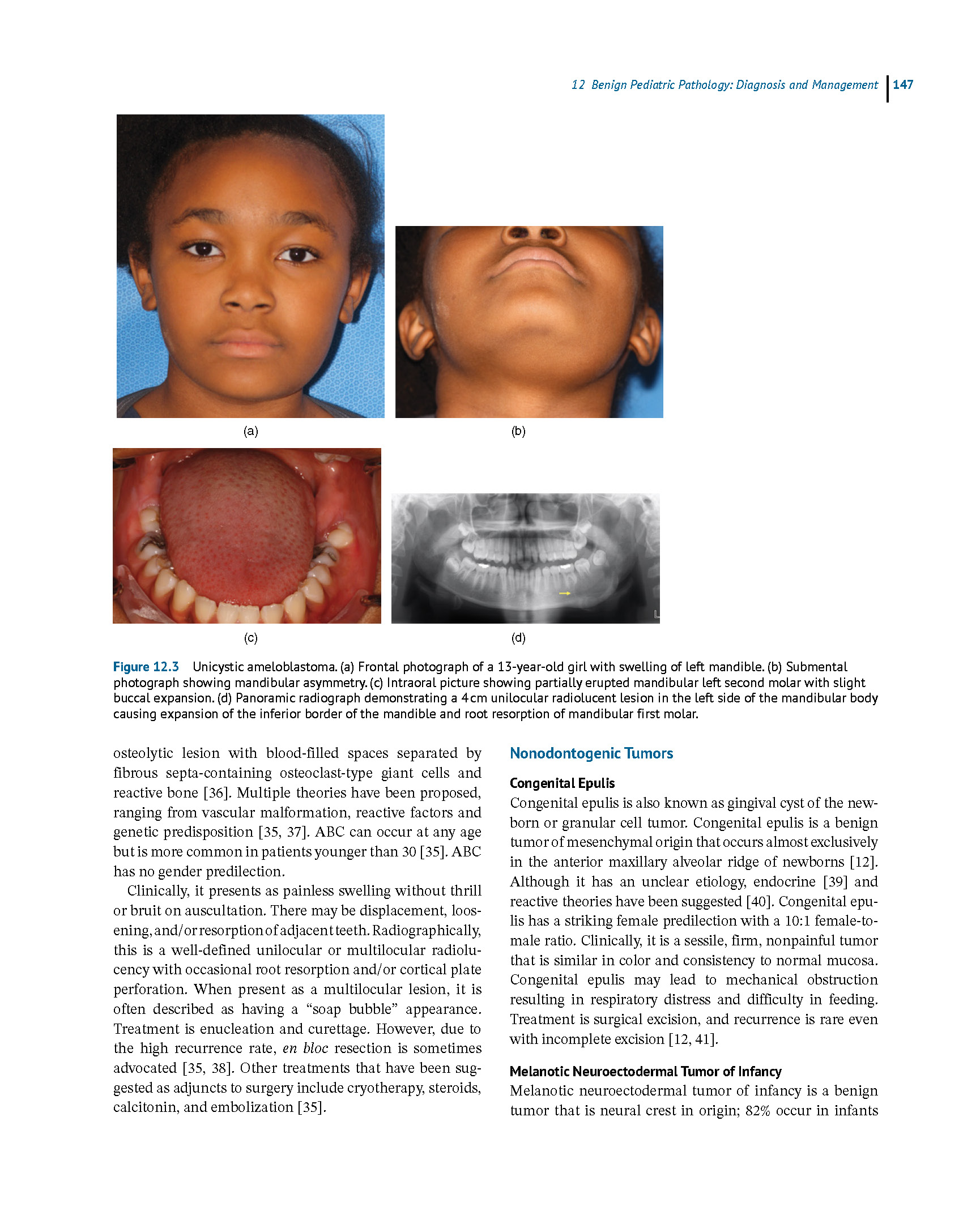 Oral and Maxillofacial Surgery, Medicine, and Pathology for the Clinician 2023 - Image 6