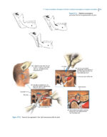 Oral and Maxillofacial Surgery, Medicine, and Pathology for the Clinician 2023 - Image 7