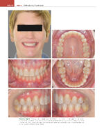 ORTHODONTICS: Current Principles and Techniques (Graber) 2023 + Supplemental Online Pages - Image 10