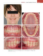 ORTHODONTICS: Current Principles and Techniques (Graber) 2023 + Supplemental Online Pages - Image 11