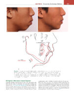ORTHODONTICS: Current Principles and Techniques (Graber) 2023 + Supplemental Online Pages - Image 12