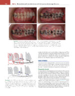 ORTHODONTICS: Current Principles and Techniques (Graber) 2023 + Supplemental Online Pages - Image 13