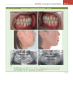 ORTHODONTICS: Current Principles and Techniques (Graber) 2023 + Supplemental Online Pages - Image 15