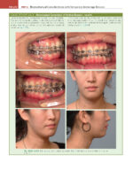 ORTHODONTICS: Current Principles and Techniques (Graber) 2023 + Supplemental Online Pages - Image 16