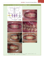 ORTHODONTICS: Current Principles and Techniques (Graber) 2023 + Supplemental Online Pages - Image 17