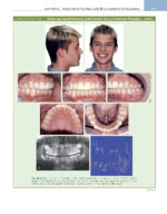 ORTHODONTICS: Current Principles and Techniques (Graber) 2023 + Supplemental Online Pages - Image 4