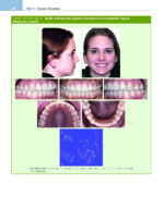 ORTHODONTICS: Current Principles and Techniques (Graber) 2023 + Supplemental Online Pages - Image 7