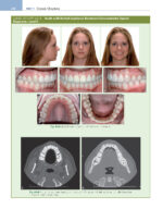 ORTHODONTICS: Current Principles and Techniques (Graber) 2023 + Supplemental Online Pages - Image 8
