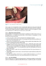 Principles of Dentoalveolar Extractions 2021 - Image 3