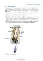 Principles of Dentoalveolar Extractions 2021 - Image 4