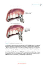 Principles of Dentoalveolar Extractions 2021 - Image 7