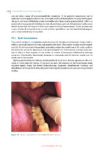 Principles of Dentoalveolar Extractions 2021 - Image 9