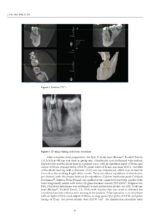 Periodontitis: Current Status and the Future 2024 - Image 2