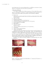 Periodontitis: Current Status and the Future 2024 - Image 6