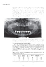 Periodontitis: Current Status and the Future 2024 - Image 7