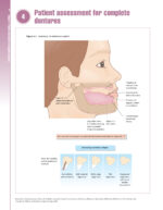 Removable Prosthodontics at a Glance 2020 - Image 3