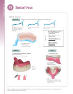 Removable Prosthodontics at a Glance 2020 - Image 5
