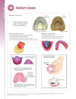 Removable Prosthodontics at a Glance 2020 - Image 6