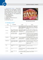 Classifications in Periodontics - A Compilation 2024 - Image 4